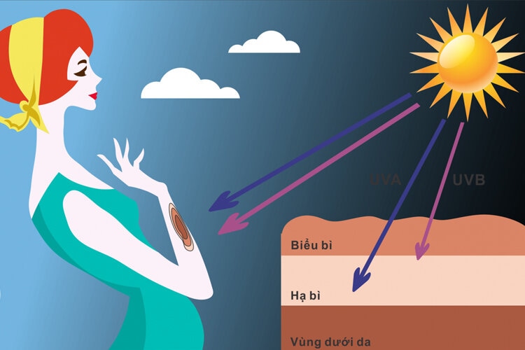 Tia Cực Tím Là Gì? Cách Phòng Tránh Tia UV Gây Hại Cho Da 3 tác hại của tia cực tím